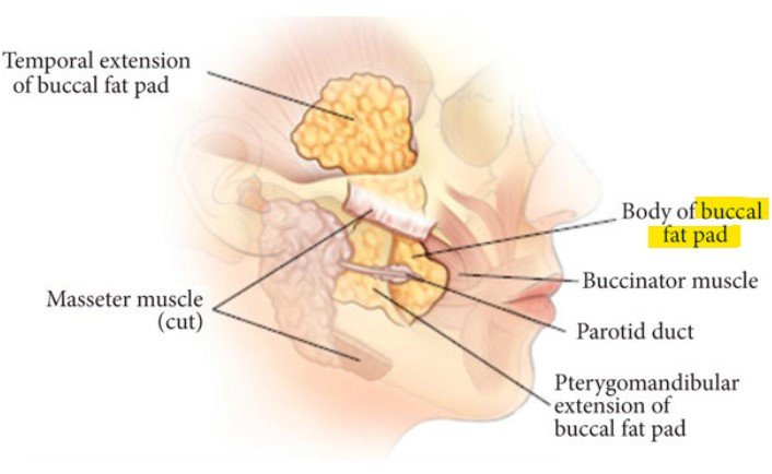 小顔手術でバッカルファットは除去は必要か？